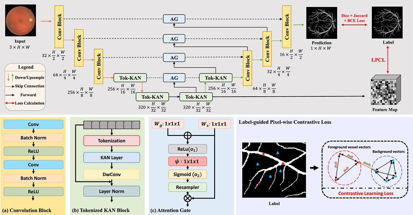 Novel Extraction of Discriminative Fine-Grained Feature to Improve Retinal Vessel Segmentation